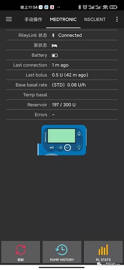 美敦力泵状态界面